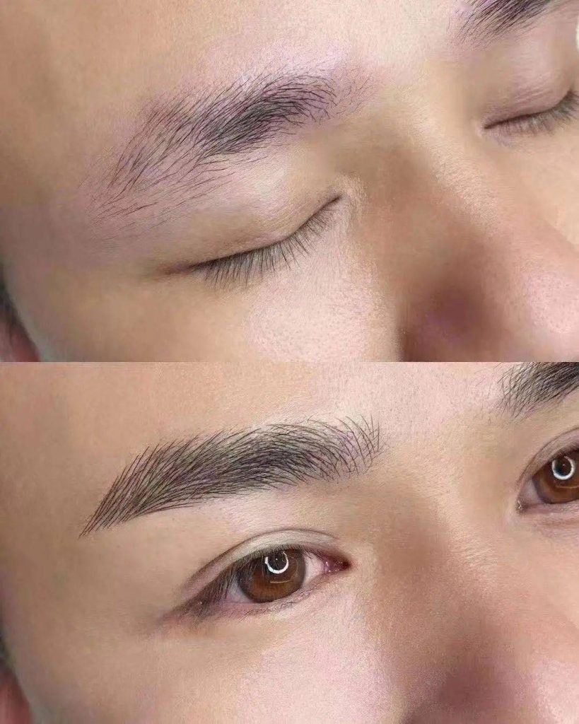 植眉后1至7天的变化图片 植眉后多久可以沾水