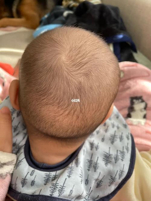 新生儿头型图片 新生儿头型图片标准