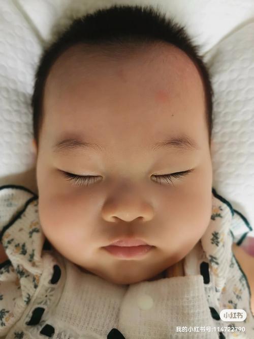 宝宝的头型图片 缺钙宝宝的头型图片