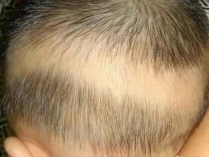 发量少宝宝发型图片 发量少的婴儿发型