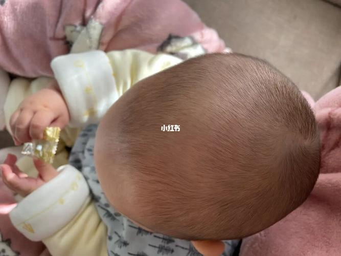 新生儿头型图片 新生儿头型图片标准