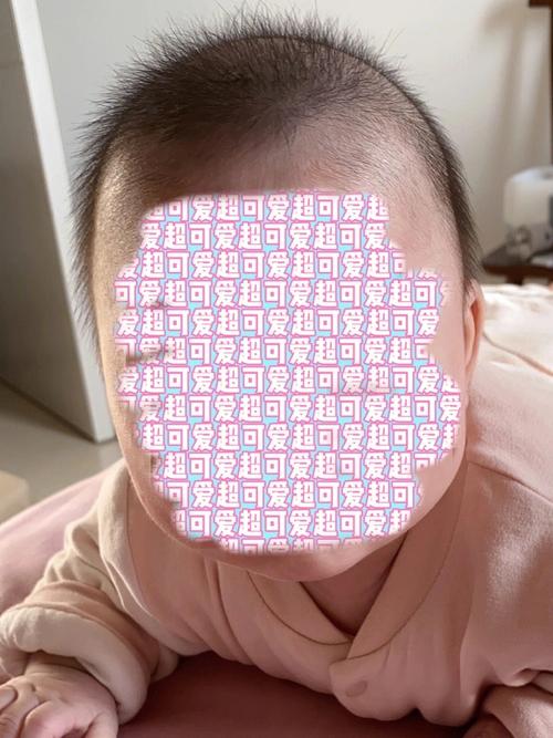 婴儿头型偏长图片 婴儿头型偏长图片大全