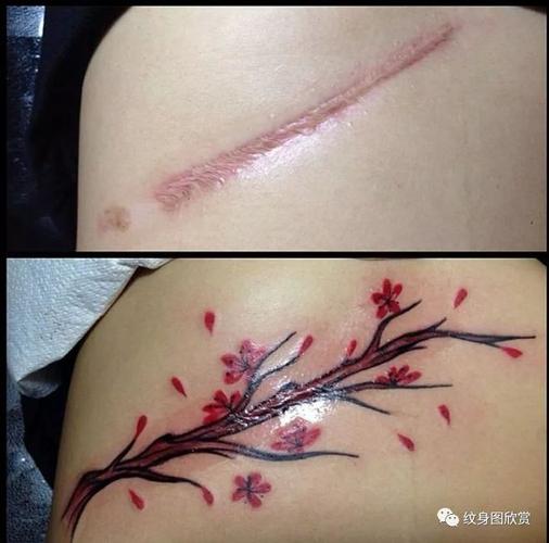 产妇疤痕纹身图片 产妇疤痕纹身图片