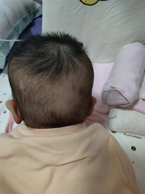 3个月宝宝发型图片 三个月宝宝发型女短发