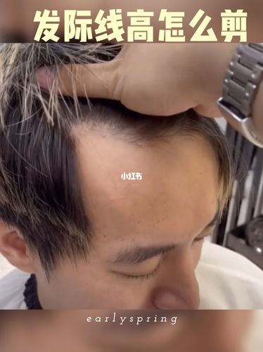 m发际线高的男生发型图 发际线高男生剪哪种头发合适