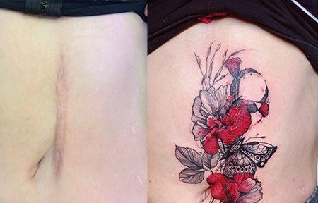 产妇疤痕纹身图片 产妇疤痕纹身图片